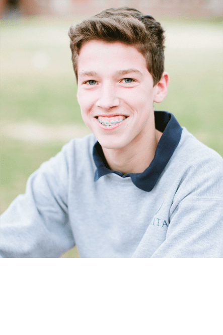 home-braces-image-3-min