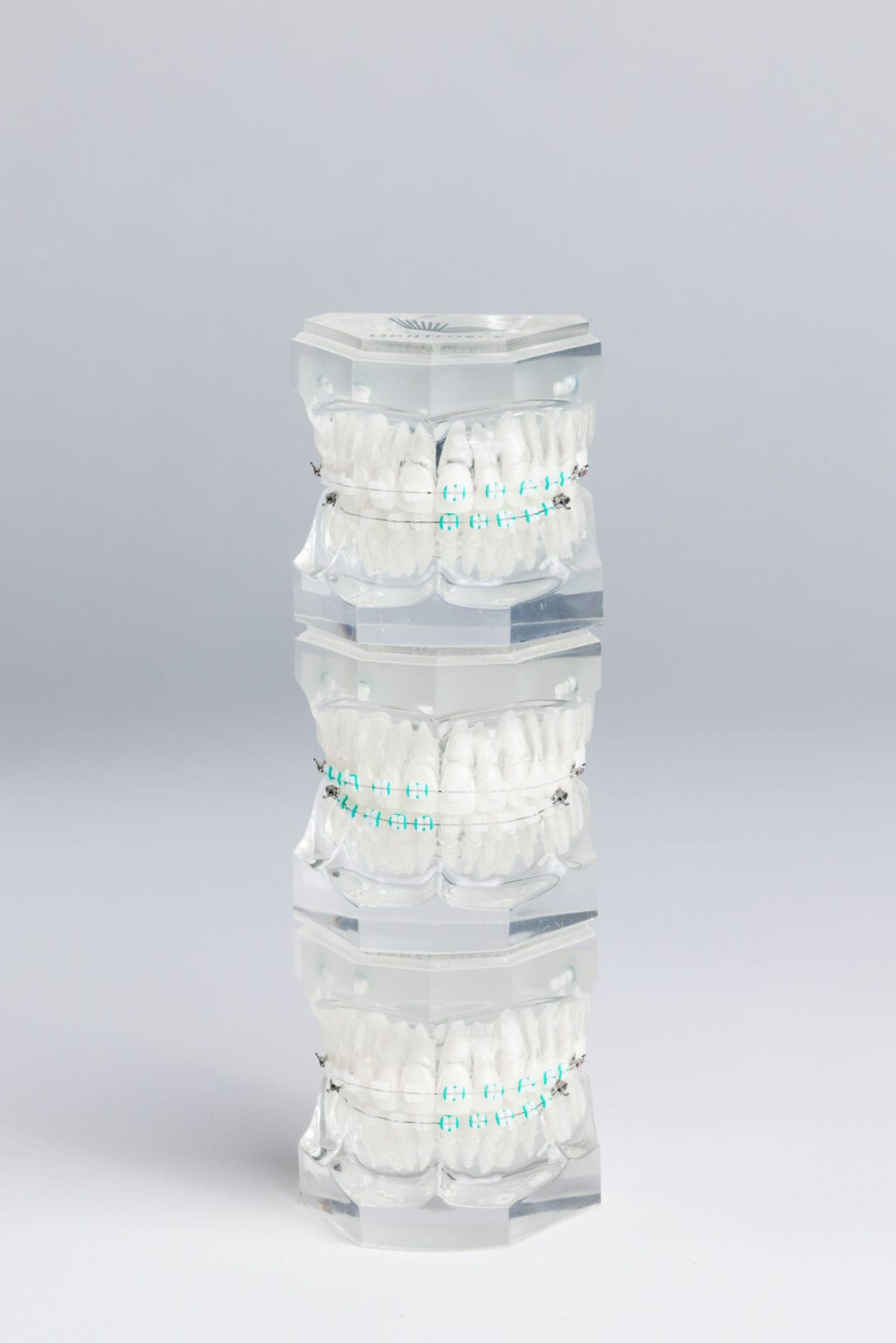 Lightforce Orthodontics Bates Orthodontics Richmond Orthodontist